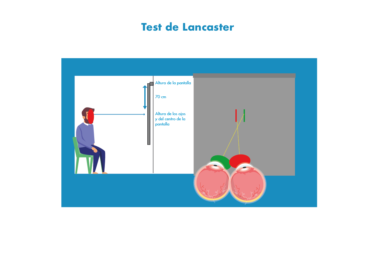 Test Lancaster