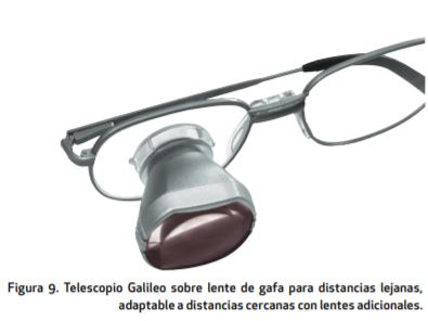 . Telescopio Galileo sobre lente de gafa para distancias lejanas, adaptable a distancias cercanas con lentes adicionales